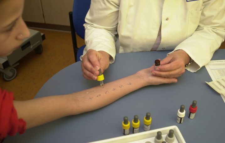 Allergietest auf der Haut 