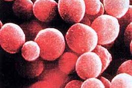 Infektionen durch Bakterien, Viren, Pilze